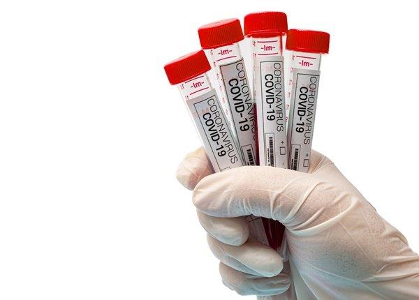 Global Care Capital: Vielversprechende COVID-Aktie vor dem Sprung?