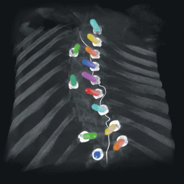 ECR 2020: New imaging solutions for enhanced clarity and cost-efficiency