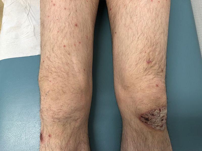 Dermatologie und Rheumatologie starten gemeinsame Sprechstunde