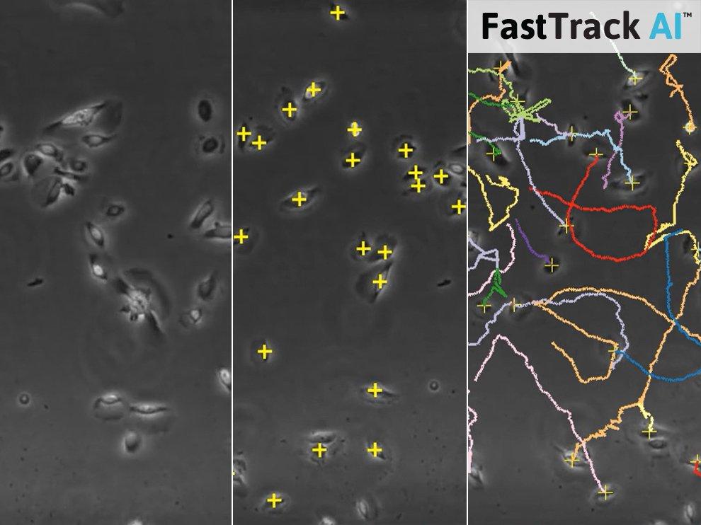 Save Time Using Automated Analysis of Chemotaxis Assays